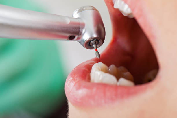 Best Emergency Dentist for Knocked-Out Tooth in Lechee, AZ